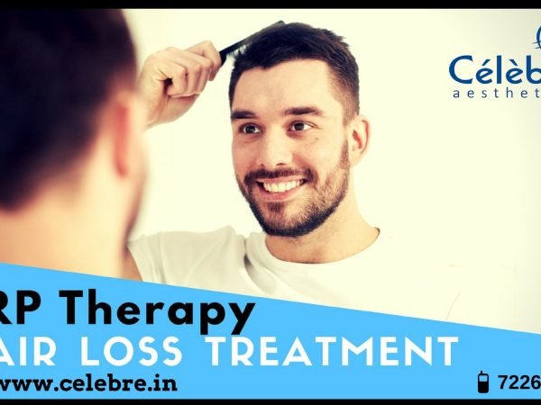 PRP-Therapy-in-Surat-at-Celebre-Aesthetics