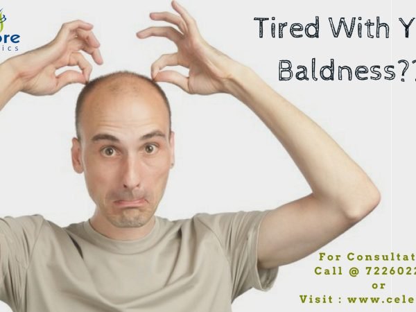 Tired-with-your-baldness