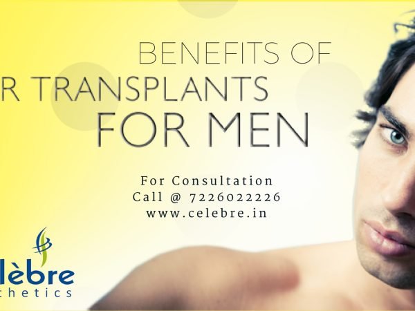 Benefits-of-Hair-Transplant