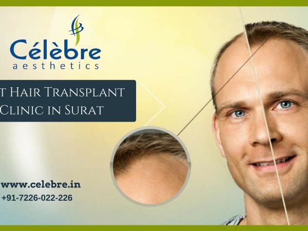 Best-Hair-Transplant-Clinic-in-Surat-Celebre-Aesthetics