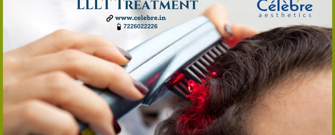 Hair-Treatment-in-Surat-LLLT-Treatment