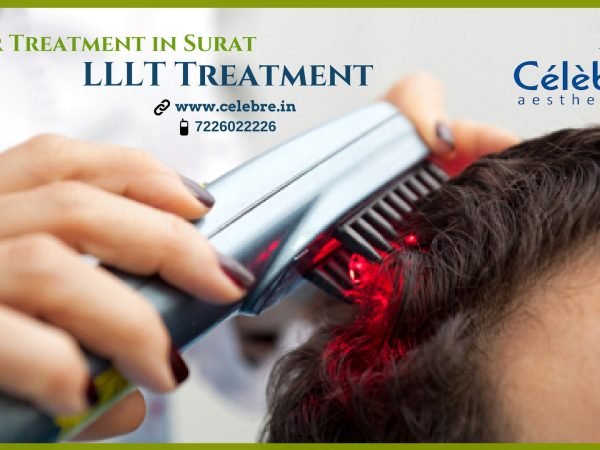 Hair-Treatment-in-Surat-LLLT-Treatment