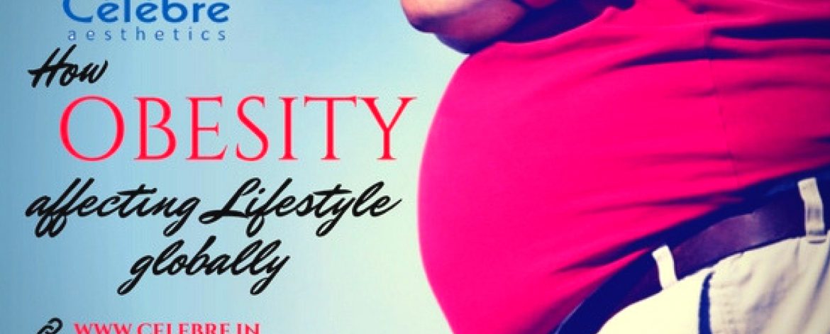 How-Obesity-is-affecting-Lifestyle-globally