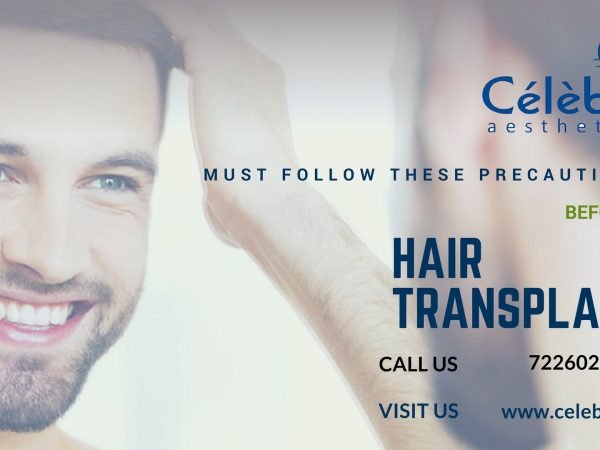 Precautions-to-follow-before-hair-transplant-surgery