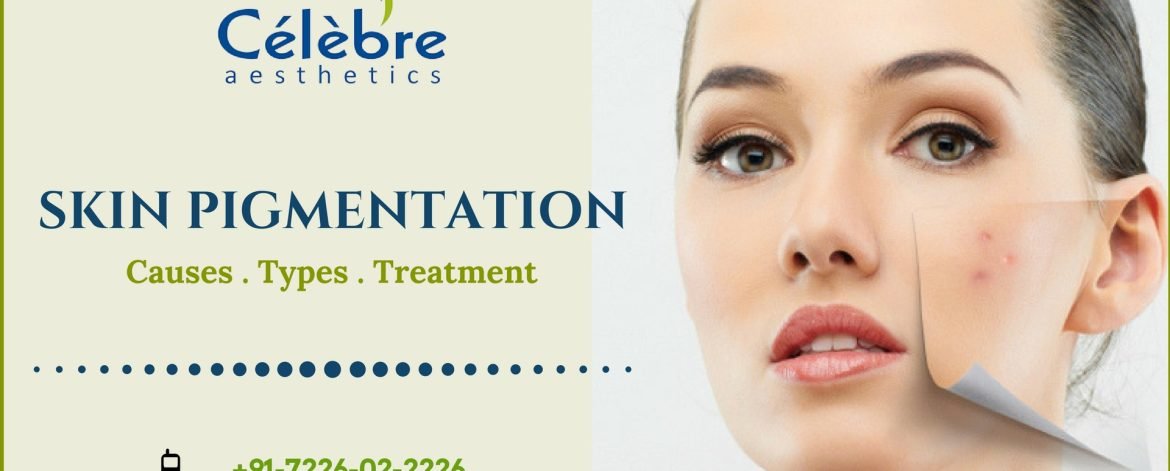 Skin-Pigmentation-Causes-Types-and-Treatment-in-Surat