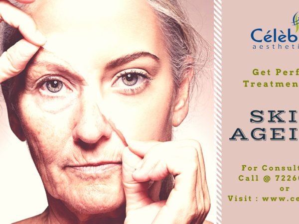 Treatment-For-Skin-Ageing