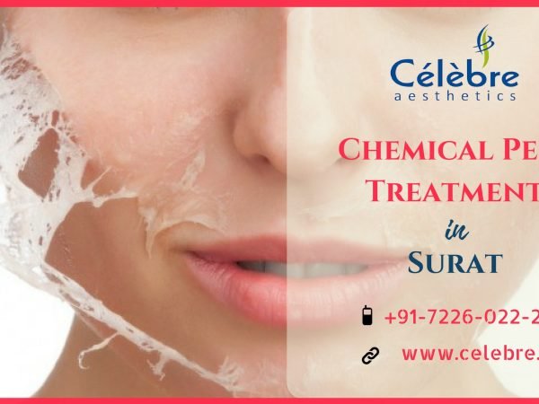 Chemical-Peel-Treatment-in-Surat-1