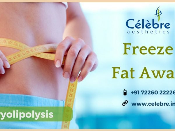 Cyrolipolysis-or-Fat-Freezing-Treatment-in-Surat