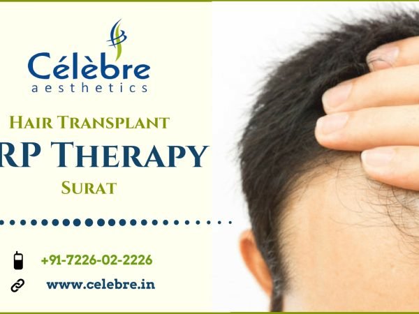 Hair-Transplant-PRP-Therapy-Surat