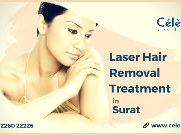 Laser-Hair-Removal-Treatment-in-Surat