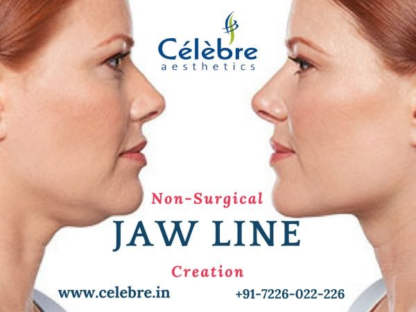 Non-Surgical-Jaw-Line-Creation