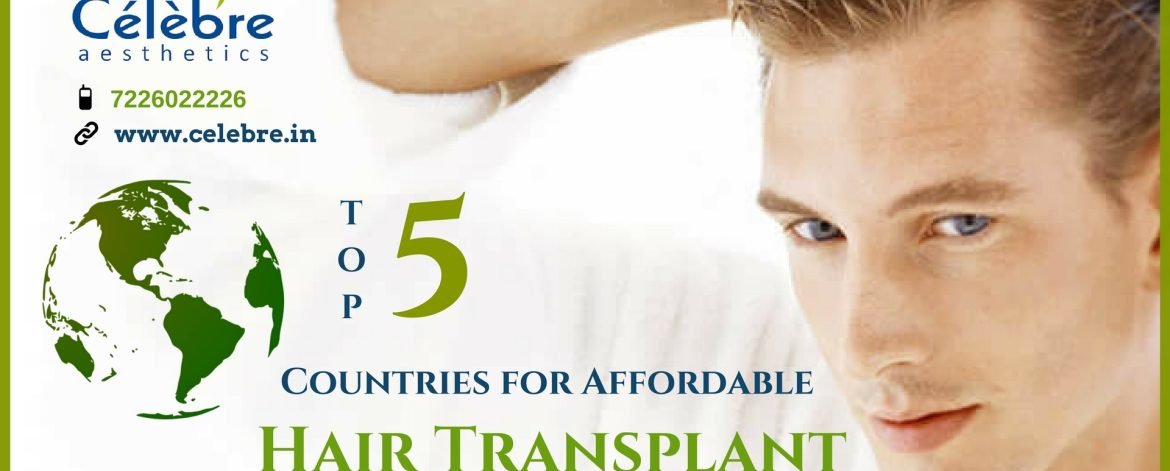 Top-5-Countries-for-Affordable-Hair-Transplant