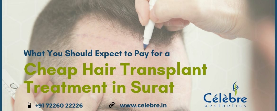 Cheap-Hair-Transplant-Treatment-in-Surat