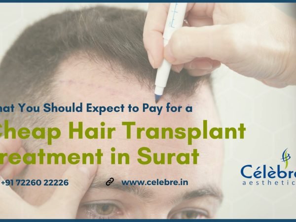 Cheap-Hair-Transplant-Treatment-in-Surat