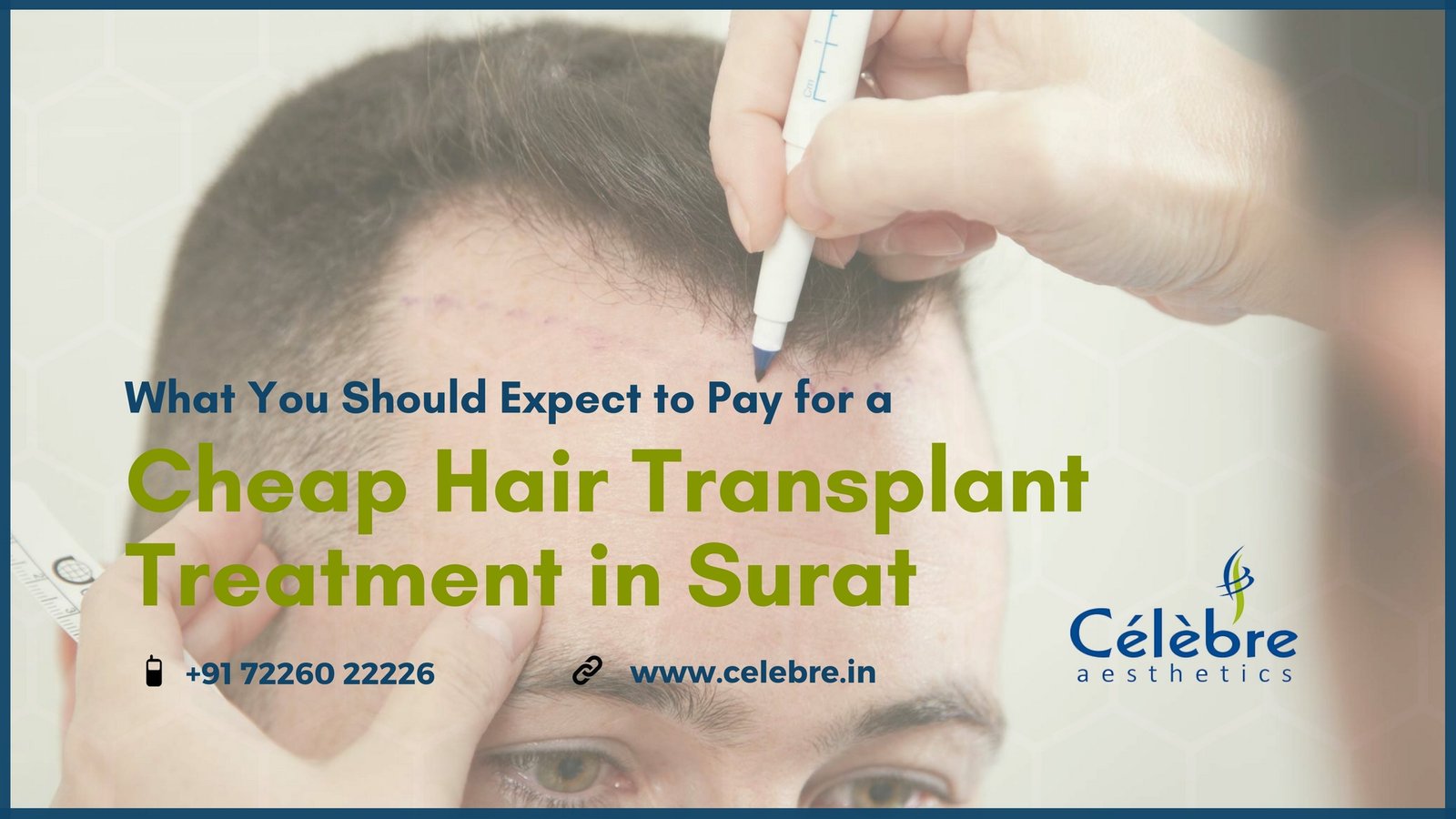 Cheap Hair Transplant Treatment in Surat