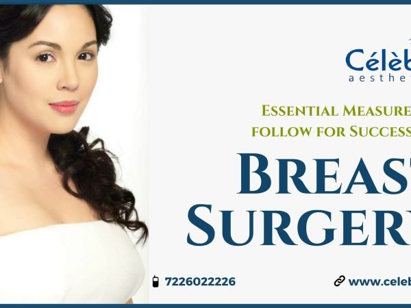 Essential-Measures-to-follow-for-Successful-Breast-Surgery