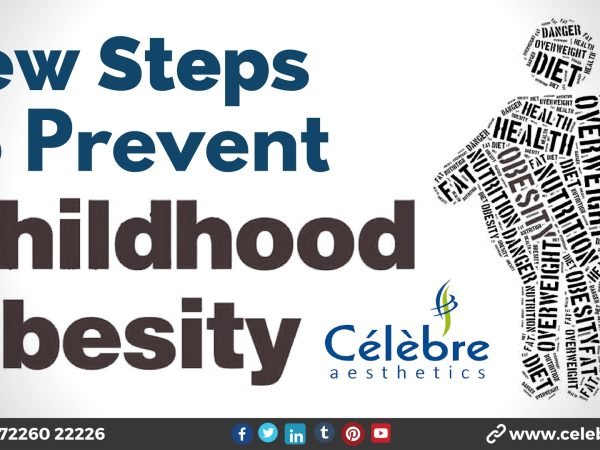 Few-Steps-to-Prevent-Childhood-Obesity