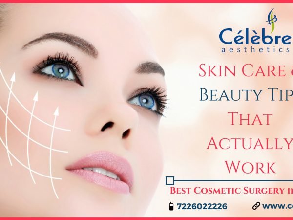 Skin-Care-and-Beauty-Tips-Best-Cosmetic-Surgery-in-Surat