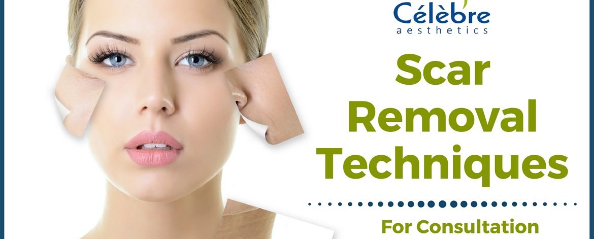 Scar-Removal-Techniques-and-Treatment-in-Surat