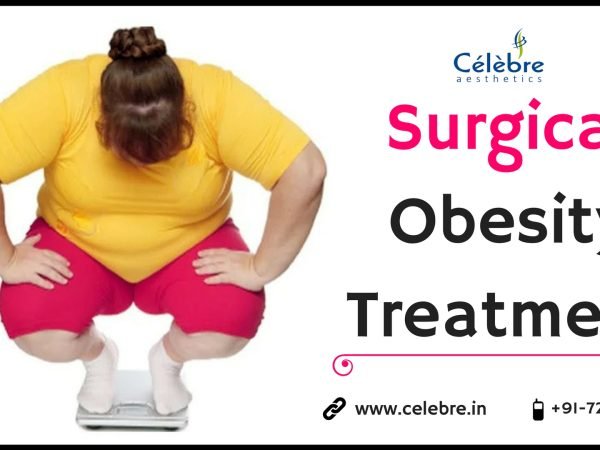 Surgical-Obesity-Treatment