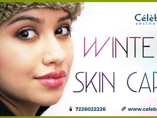 Winter-Season-Skin-Care-Tips