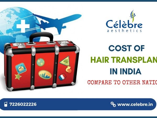 COST-OF-HAIR-TRANSPLANT-IN-INDIA-COMPARE-TO-OTHER-NATIONS