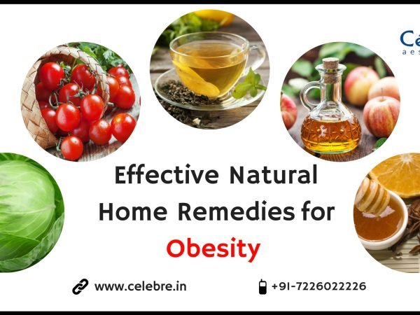 Effective-Natural-Cure-for-Obesity-Must-Try-These-Home-Remedies-1