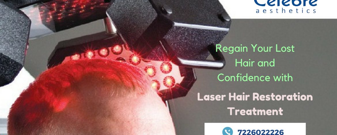 Laser-Hair-Restoration-Treatment-in-Surat