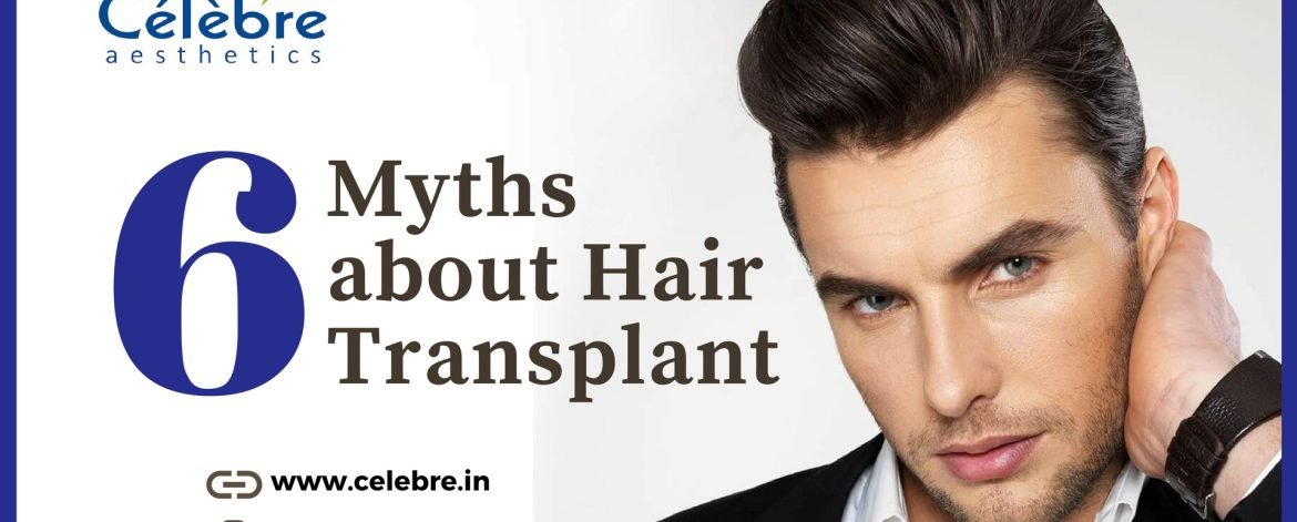6_Myths_About_Hair_Transplant