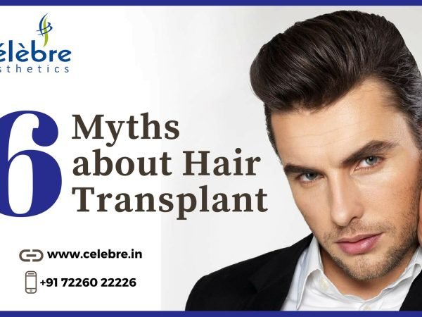 6_Myths_About_Hair_Transplant