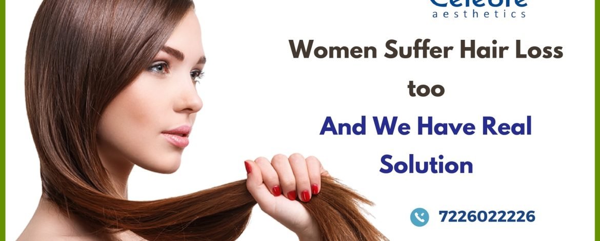 Best-Hair-Transplant-in-Surat-for-Women