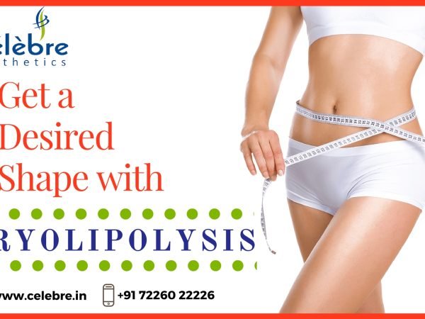 Cryolipolysis-Treatment