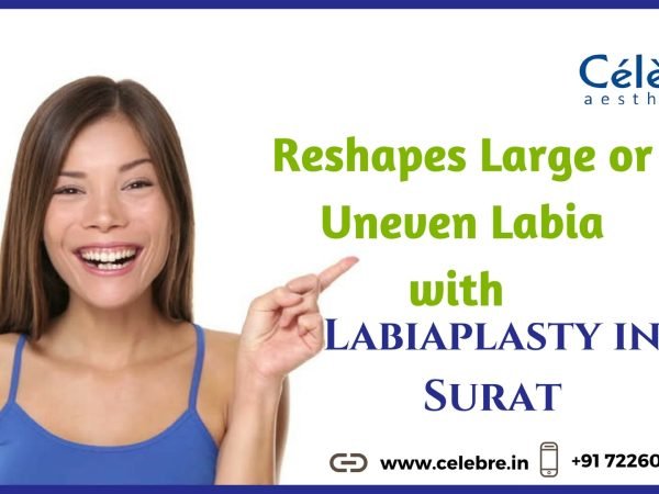 Labiaplasty-in-Surat-min