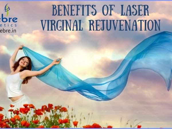 Benefits-of-laser-virginal-rejuvenation