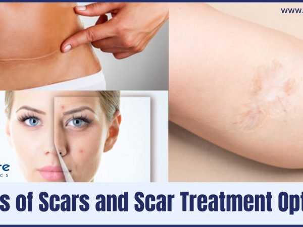 Scar-Treatment-Options-in-Surat