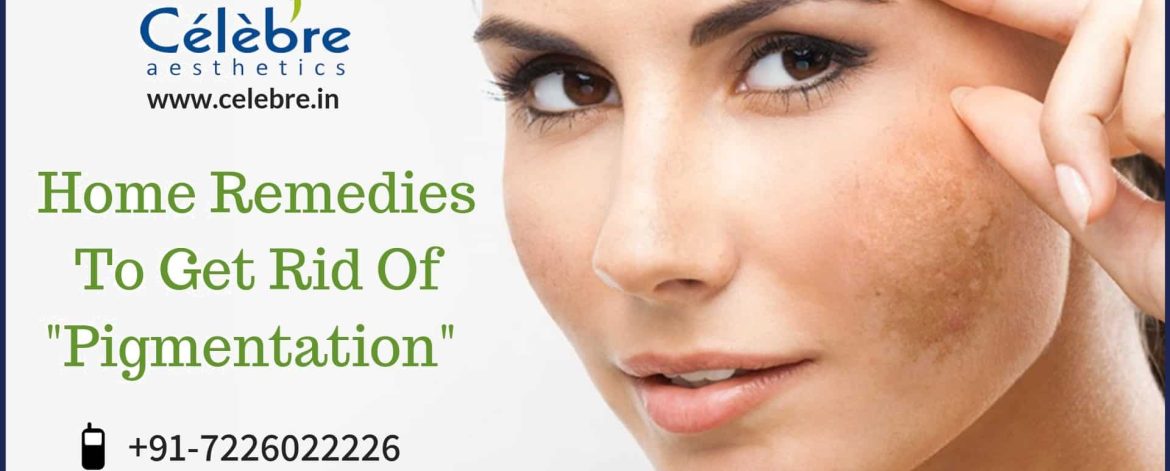 Home-remedies-to-get-rid-of-pigmentation