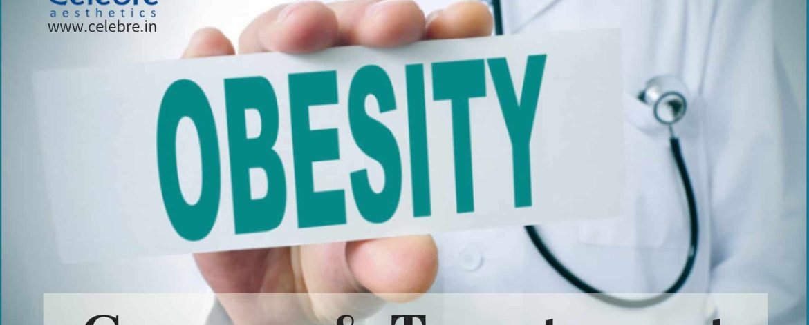 Causes-of-Obesity-Effective-Treatment-Option