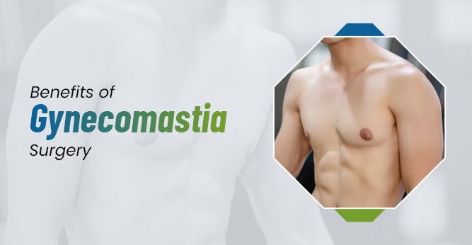 Benefits of Gynecomastia Surgery