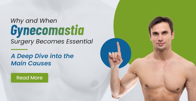 Why and When Gynecomastia Surgery Becomes Essential: A Deep Dive into the Main Causes