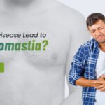 Can Liver Disease Lead to Gynecomastia