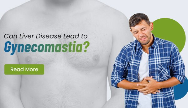 Can Liver Disease Lead to Gynecomastia