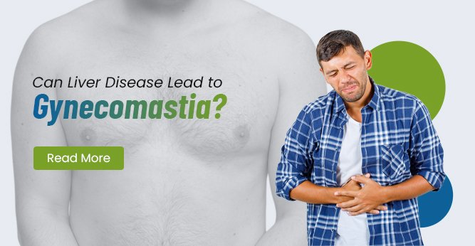 Can Liver Disease Lead to Gynecomastia