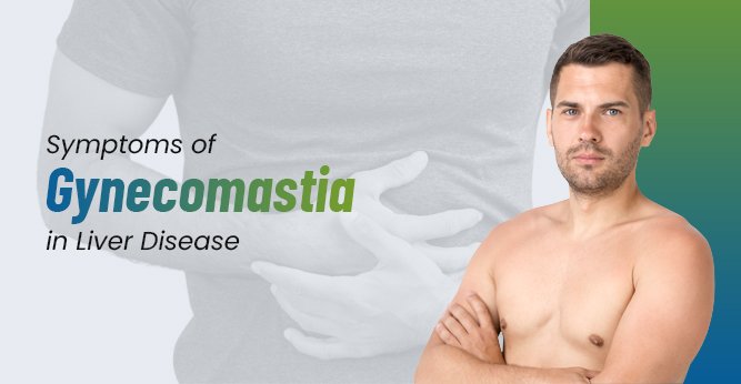 Symptoms of Gynecomastia in Liver Disease