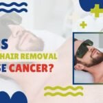 Does Laser Hair Removal Cause Cancer