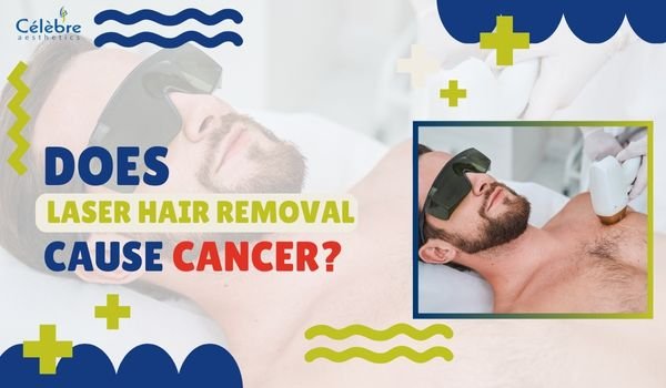 Does Laser Hair Removal Cause Cancer