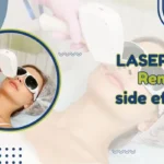 laser hair removal side effects