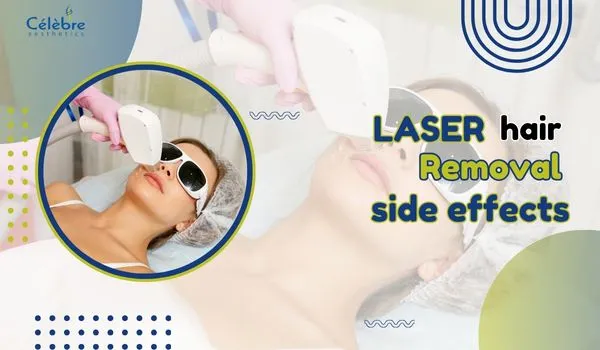 laser hair removal side effects