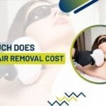 how much does laser hair removal cost