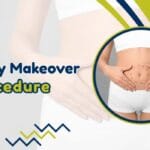 Mommy Makeover