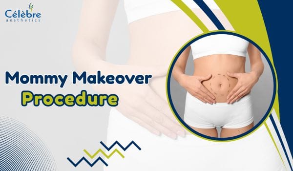 Mommy Makeover